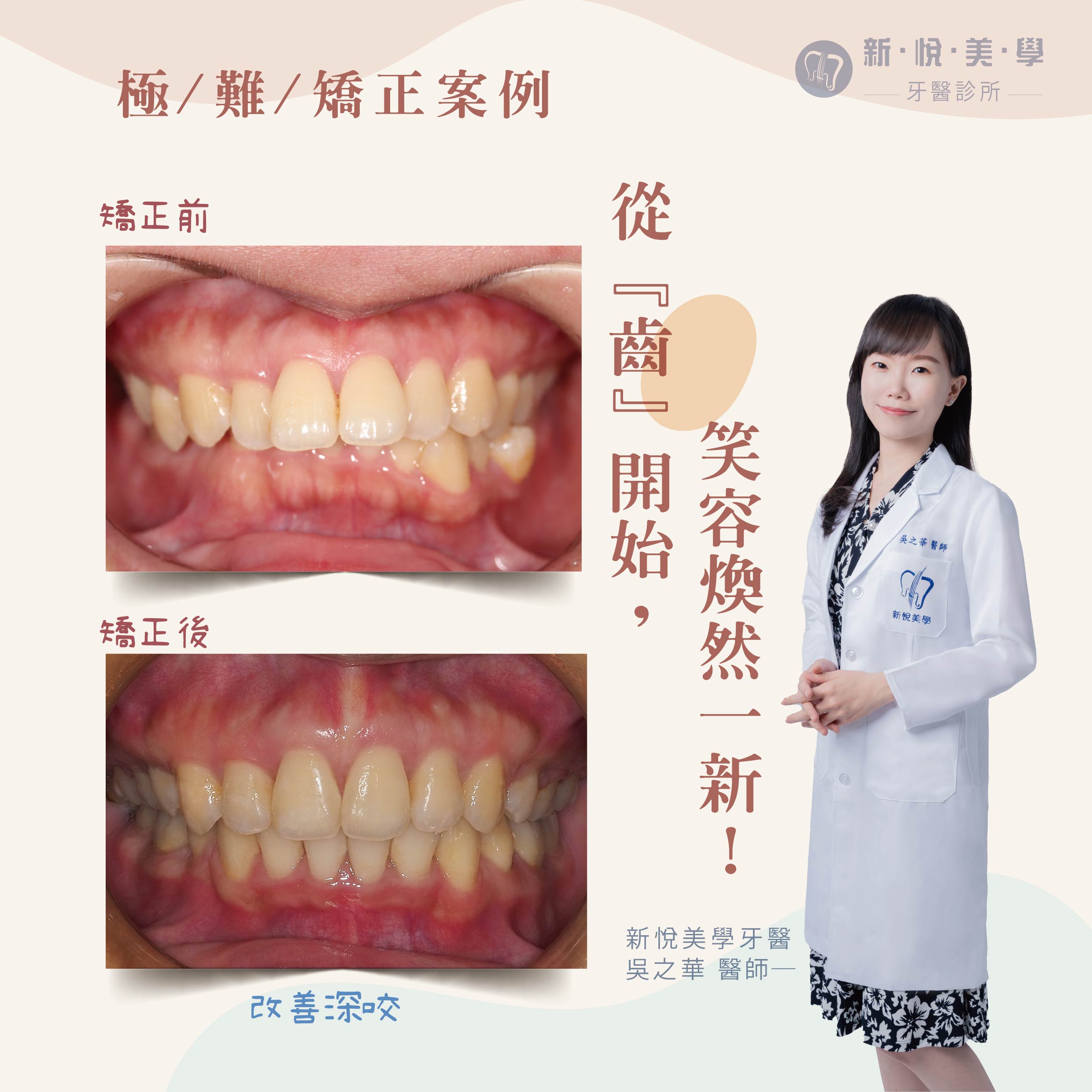 新悅美學牙醫診所的案例分享圖片